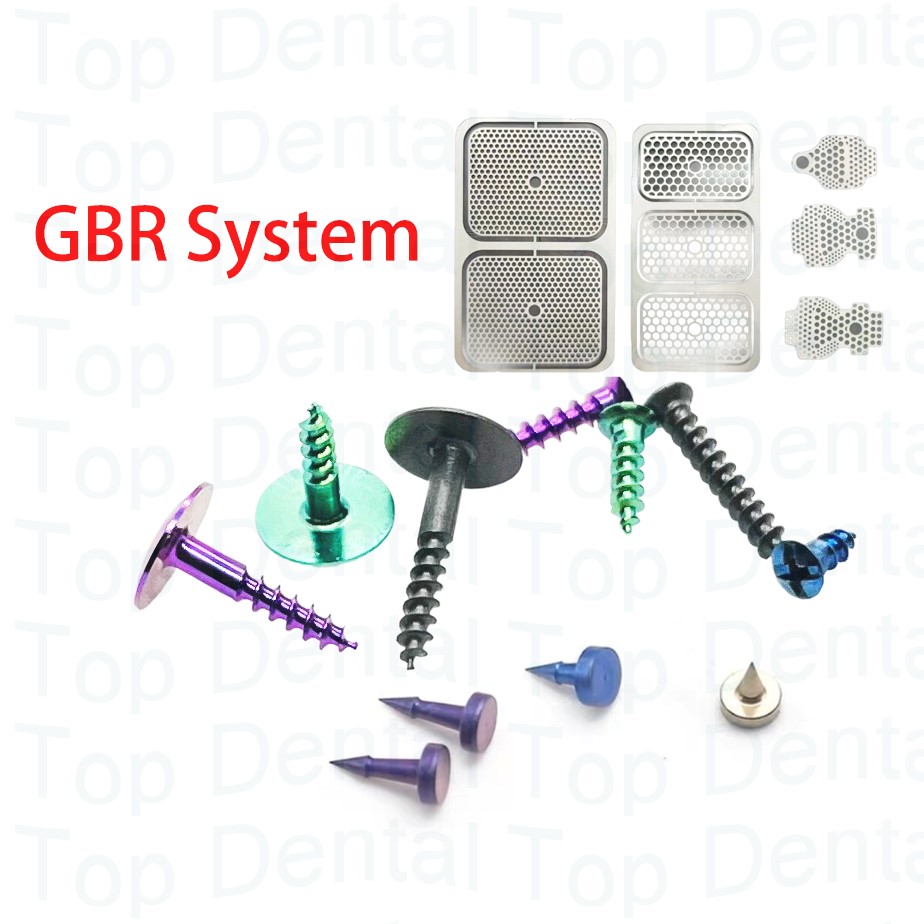 10 pcs Sistem GBR Gigi, Sekrup - Stabilizer Screw In ulasan dan harga