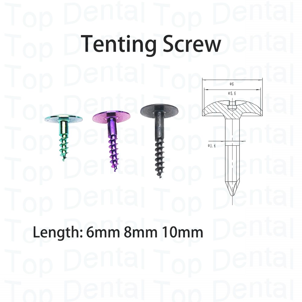 10 pcs Sistem GBR Gigi, Sekrup - Stabilizer Screw In ulasan dan harga