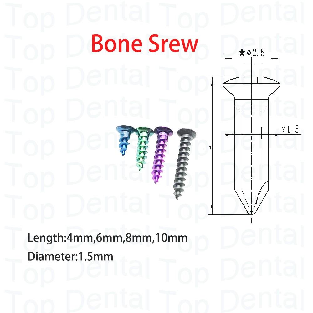 10 pcs Sistem GBR Gigi, Sekrup - Stabilizer Screw In ulasan dan harga